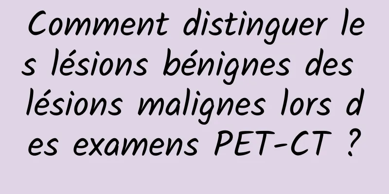 Comment distinguer les lésions bénignes des lésions malignes lors des examens PET-CT ?