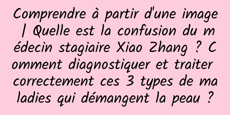 Comprendre à partir d'une image | Quelle est la confusion du médecin stagiaire Xiao Zhang ? Comment diagnostiquer et traiter correctement ces 3 types de maladies qui démangent la peau ?