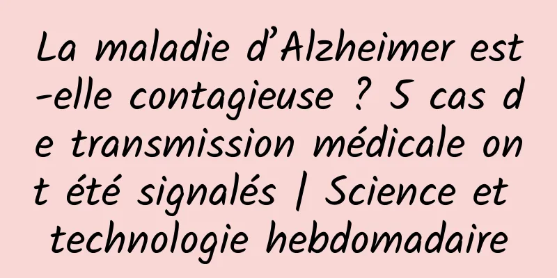 La maladie d’Alzheimer est-elle contagieuse ? 5 cas de transmission médicale ont été signalés | Science et technologie hebdomadaire