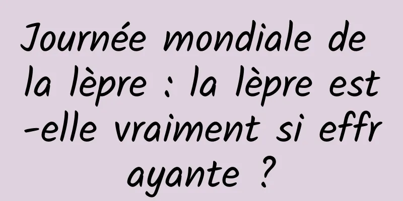 Journée mondiale de la lèpre : la lèpre est-elle vraiment si effrayante ?