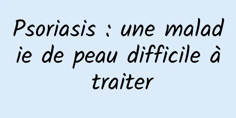 Psoriasis : une maladie de peau difficile à traiter