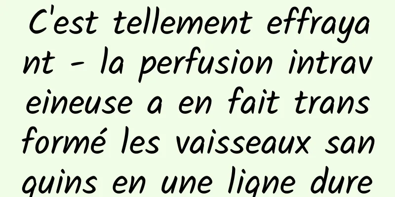C'est tellement effrayant - la perfusion intraveineuse a en fait transformé les vaisseaux sanguins en une ligne dure