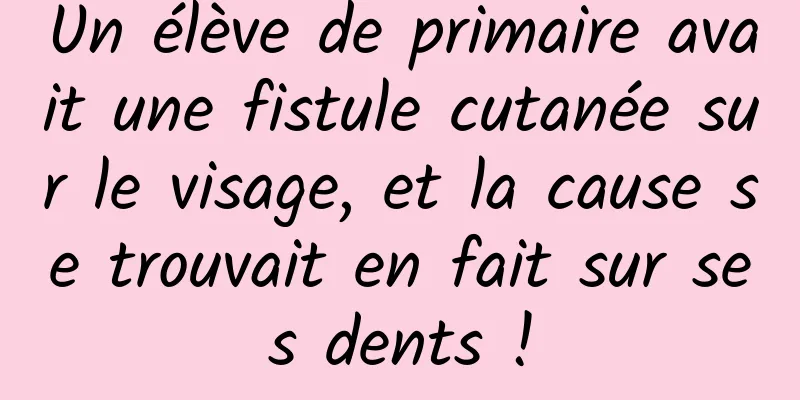 Un élève de primaire avait une fistule cutanée sur le visage, et la cause se trouvait en fait sur ses dents !