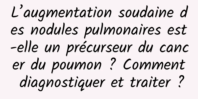 L’augmentation soudaine des nodules pulmonaires est-elle un précurseur du cancer du poumon ? Comment diagnostiquer et traiter ?