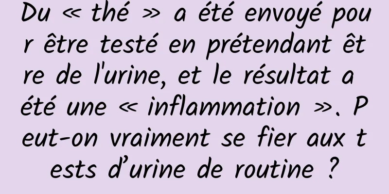 Du « thé » a été envoyé pour être testé en prétendant être de l'urine, et le résultat a été une « inflammation ». Peut-on vraiment se fier aux tests d’urine de routine ?