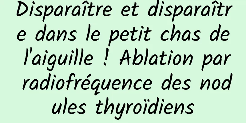 Disparaître et disparaître dans le petit chas de l'aiguille ! Ablation par radiofréquence des nodules thyroïdiens