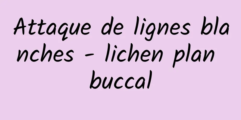 Attaque de lignes blanches - lichen plan buccal