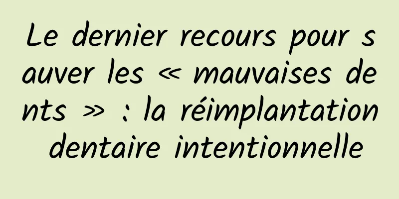 Le dernier recours pour sauver les « mauvaises dents » : la réimplantation dentaire intentionnelle