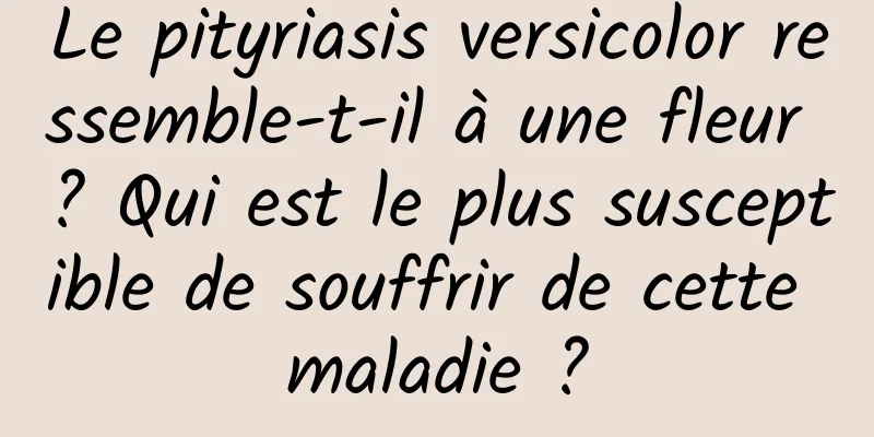 Le pityriasis versicolor ressemble-t-il à une fleur ? Qui est le plus susceptible de souffrir de cette maladie ?