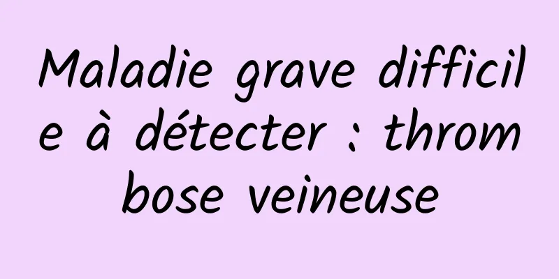 Maladie grave difficile à détecter : thrombose veineuse