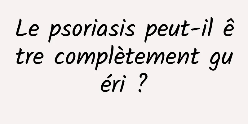Le psoriasis peut-il être complètement guéri ?
