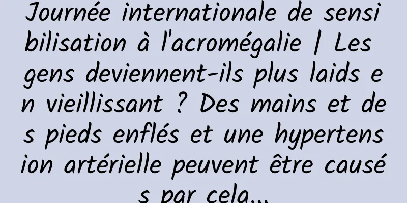 Journée internationale de sensibilisation à l'acromégalie | Les gens deviennent-ils plus laids en vieillissant ? Des mains et des pieds enflés et une hypertension artérielle peuvent être causés par cela...