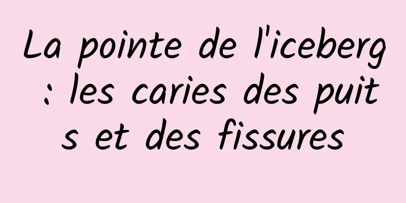 La pointe de l'iceberg : les caries des puits et des fissures