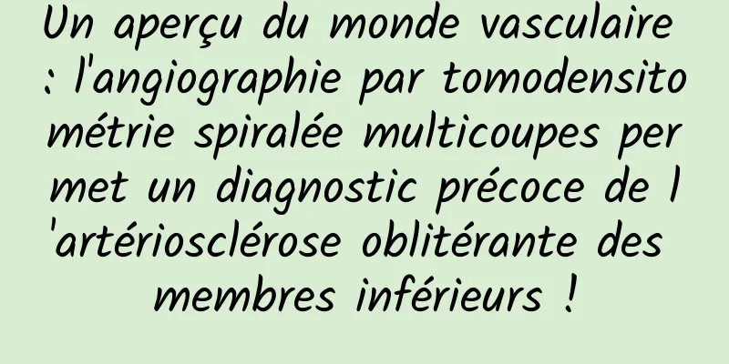 Un aperçu du monde vasculaire : l'angiographie par tomodensitométrie spiralée multicoupes permet un diagnostic précoce de l'artériosclérose oblitérante des membres inférieurs !