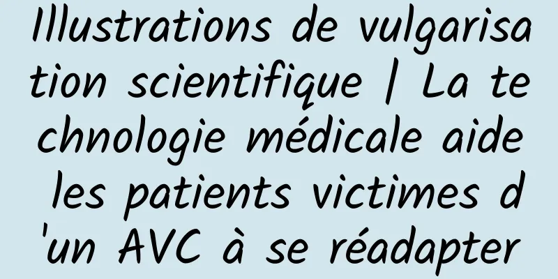Illustrations de vulgarisation scientifique | La technologie médicale aide les patients victimes d'un AVC à se réadapter