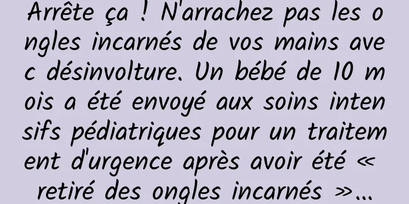 Arrête ça ! N'arrachez pas les ongles incarnés de vos mains avec désinvolture. Un bébé de 10 mois a été envoyé aux soins intensifs pédiatriques pour un traitement d'urgence après avoir été « retiré des ongles incarnés »...