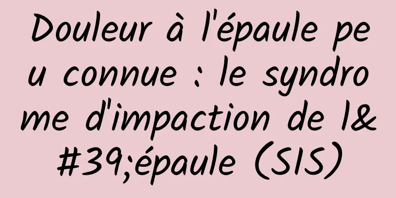 Douleur à l'épaule peu connue : le syndrome d'impaction de l'épaule (SIS)