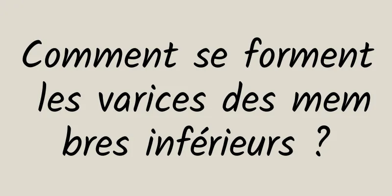 Comment se forment les varices des membres inférieurs ?