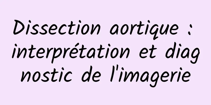 Dissection aortique : interprétation et diagnostic de l'imagerie