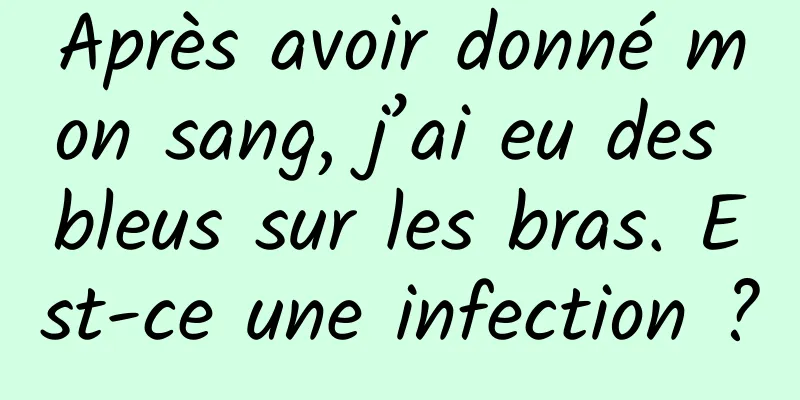 Après avoir donné mon sang, j’ai eu des bleus sur les bras. Est-ce une infection ?