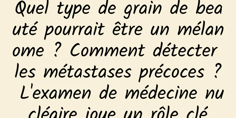 Quel type de grain de beauté pourrait être un mélanome ? Comment détecter les métastases précoces ? L'examen de médecine nucléaire joue un rôle clé