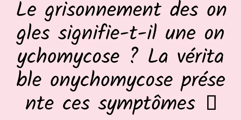 Le grisonnement des ongles signifie-t-il une onychomycose ? La véritable onychomycose présente ces symptômes →