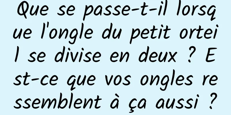 Que se passe-t-il lorsque l'ongle du petit orteil se divise en deux ? Est-ce que vos ongles ressemblent à ça aussi ?