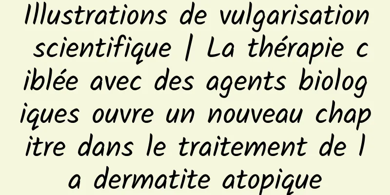 Illustrations de vulgarisation scientifique | La thérapie ciblée avec des agents biologiques ouvre un nouveau chapitre dans le traitement de la dermatite atopique
