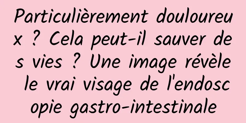 Particulièrement douloureux ? Cela peut-il sauver des vies ? Une image révèle le vrai visage de l'endoscopie gastro-intestinale