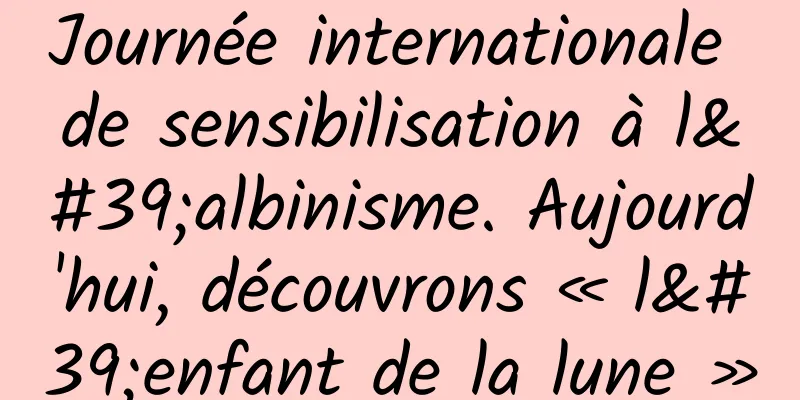 Journée internationale de sensibilisation à l'albinisme. Aujourd'hui, découvrons « l'enfant de la lune »