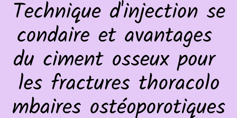 Technique d'injection secondaire et avantages du ciment osseux pour les fractures thoracolombaires ostéoporotiques