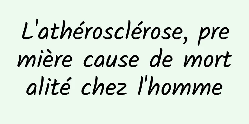 L'athérosclérose, première cause de mortalité chez l'homme