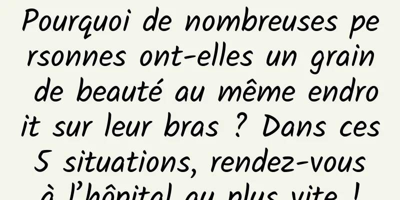 Pourquoi de nombreuses personnes ont-elles un grain de beauté au même endroit sur leur bras ? Dans ces 5 situations, rendez-vous à l’hôpital au plus vite !