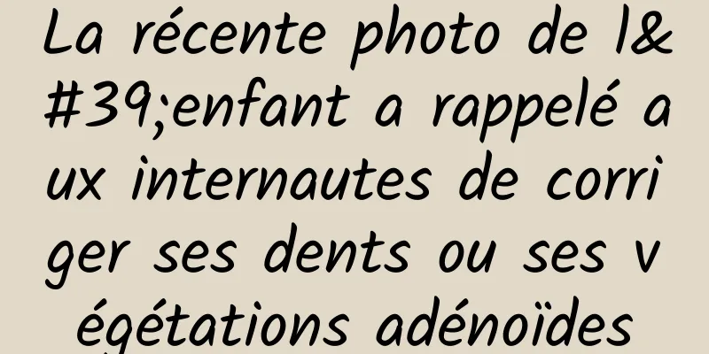 La récente photo de l'enfant a rappelé aux internautes de corriger ses dents ou ses végétations adénoïdes