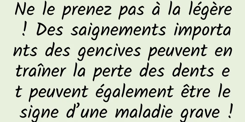 Ne le prenez pas à la légère ! Des saignements importants des gencives peuvent entraîner la perte des dents et peuvent également être le signe d’une maladie grave !
