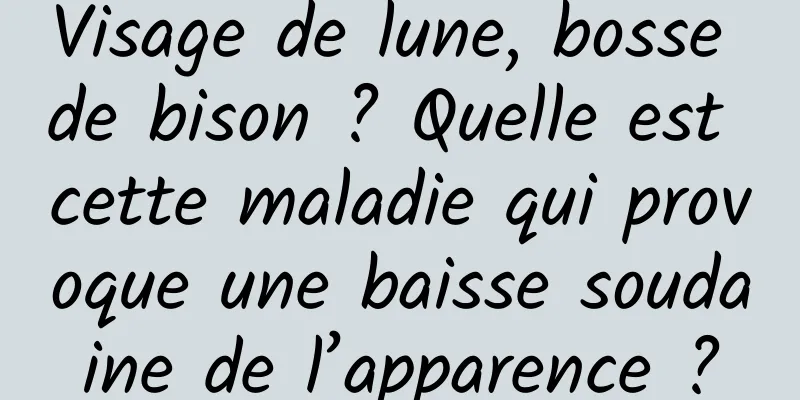 Visage de lune, bosse de bison ? Quelle est cette maladie qui provoque une baisse soudaine de l’apparence ?