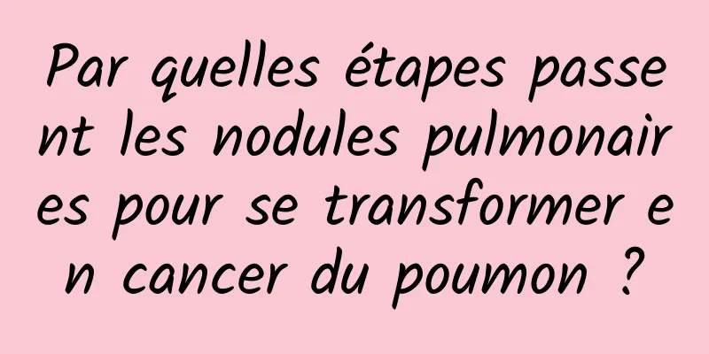 Par quelles étapes passent les nodules pulmonaires pour se transformer en cancer du poumon ?