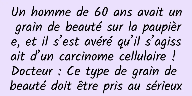 Un homme de 60 ans avait un grain de beauté sur la paupière, et il s’est avéré qu’il s’agissait d’un carcinome cellulaire ! Docteur : Ce type de grain de beauté doit être pris au sérieux