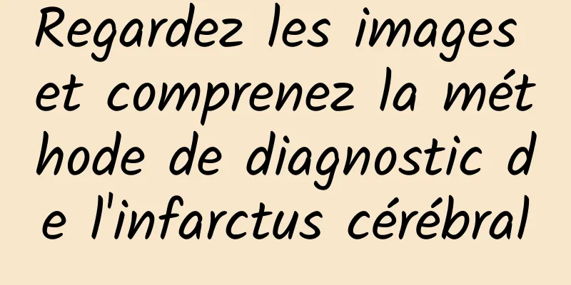 Regardez les images et comprenez la méthode de diagnostic de l'infarctus cérébral