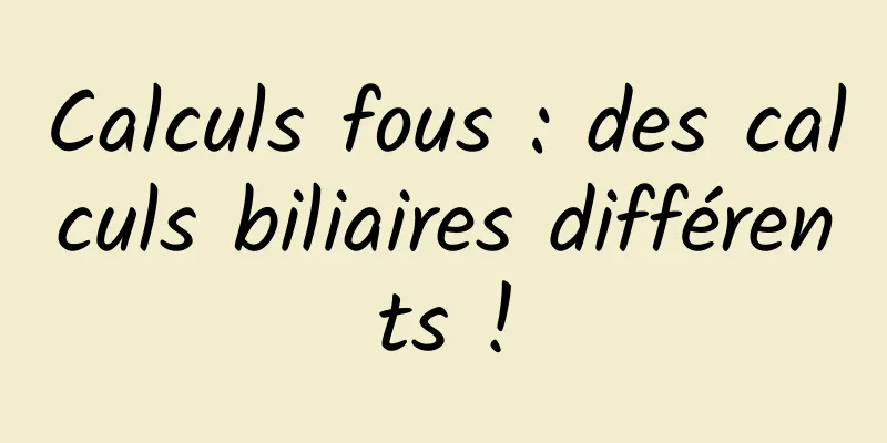 Calculs fous : des calculs biliaires différents !