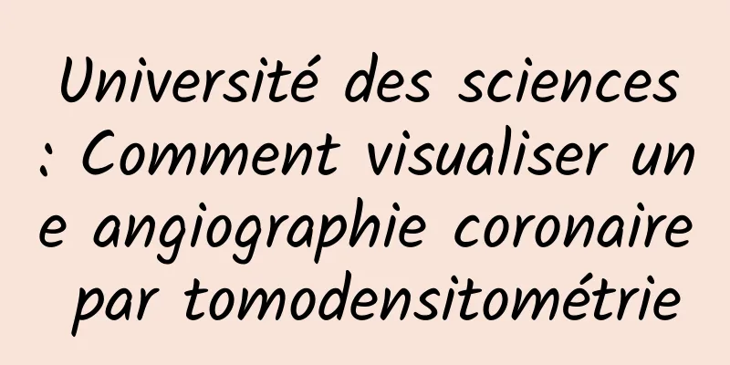 Université des sciences : Comment visualiser une angiographie coronaire par tomodensitométrie