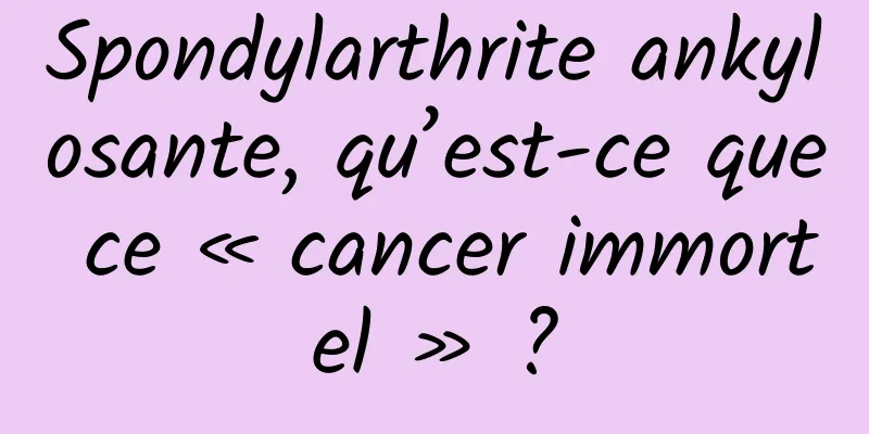 Spondylarthrite ankylosante, qu’est-ce que ce « cancer immortel » ?