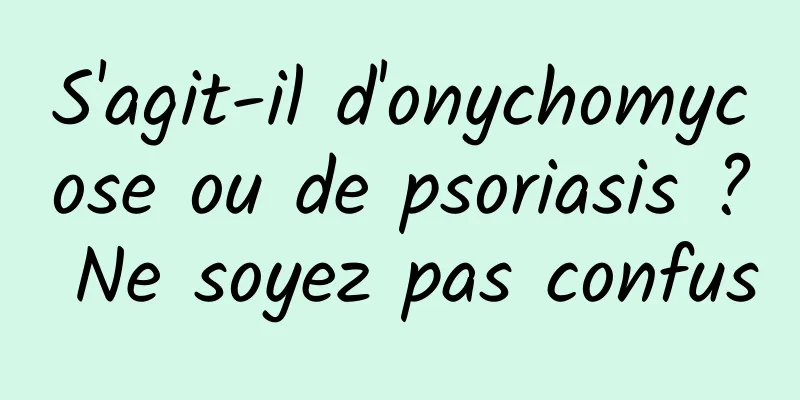 S'agit-il d'onychomycose ou de psoriasis ? Ne soyez pas confus
