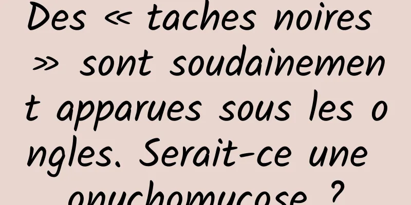 Des « taches noires » sont soudainement apparues sous les ongles. Serait-ce une onychomycose ?