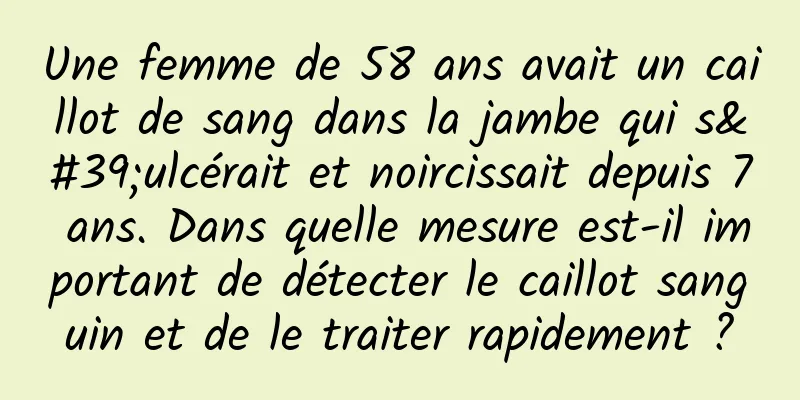 Une femme de 58 ans avait un caillot de sang dans la jambe qui s'ulcérait et noircissait depuis 7 ans. Dans quelle mesure est-il important de détecter le caillot sanguin et de le traiter rapidement ?