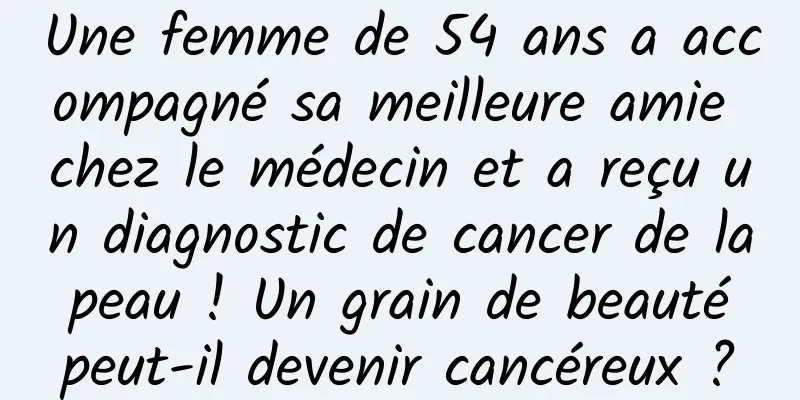 Une femme de 54 ans a accompagné sa meilleure amie chez le médecin et a reçu un diagnostic de cancer de la peau ! Un grain de beauté peut-il devenir cancéreux ?