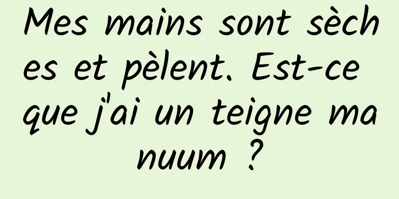 Mes mains sont sèches et pèlent. Est-ce que j'ai un teigne manuum ?