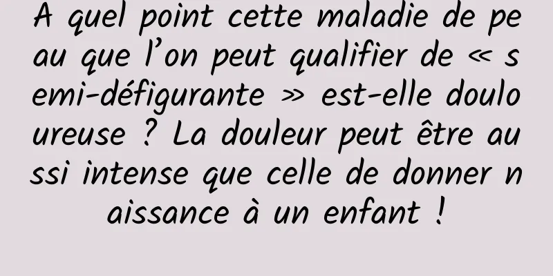 À quel point cette maladie de peau que l’on peut qualifier de « semi-défigurante » est-elle douloureuse ? La douleur peut être aussi intense que celle de donner naissance à un enfant !