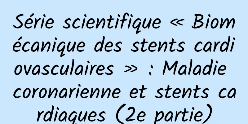 Série scientifique « Biomécanique des stents cardiovasculaires » : Maladie coronarienne et stents cardiaques (2e partie)