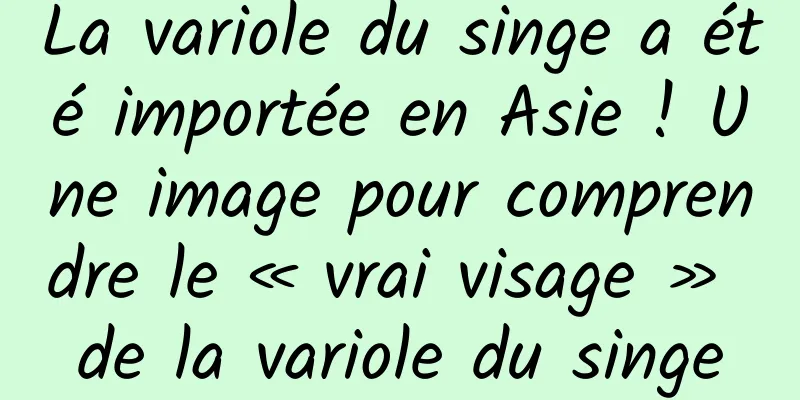 La variole du singe a été importée en Asie ! Une image pour comprendre le « vrai visage » de la variole du singe